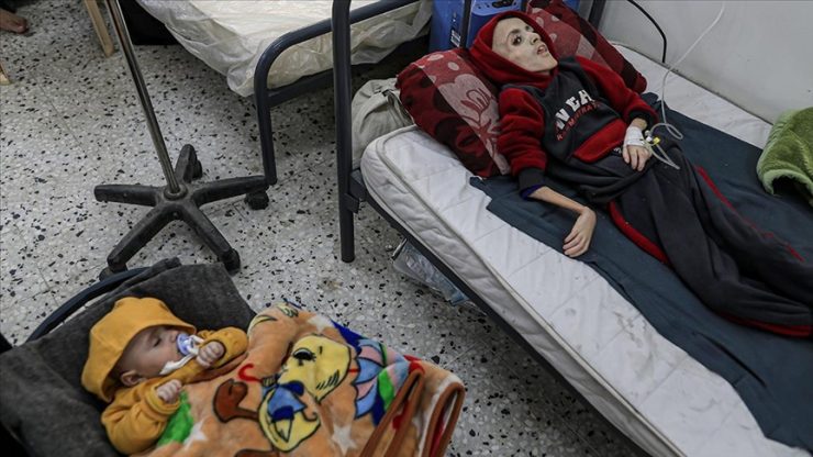 Gazze’deki Sağlık Bakanlığı: Dünya gelecek günlerde çok fazla sayıda açlıktan ölüme tanık olacak
